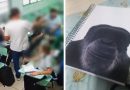 Professor é condenado por comparar aluno negro a um chimpanzé